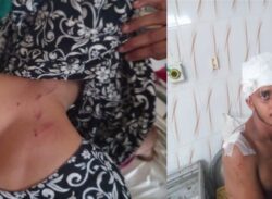 ঝালকাঠিতে জমিজমার বিরোধে প্রতিপক্ষের হামলায় মা ও ছেলে আহত